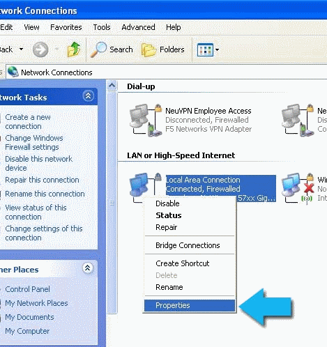 Настройка dns windows xp